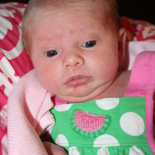 Double Chin